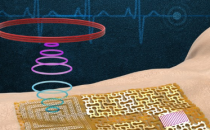 麻省理工学院的研究人员设计了一种具有各种无线传感器的无电池可穿戴电子皮肤
