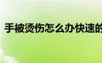 手被烫伤怎么办快速的办法 手被烫伤怎么办