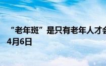 “老年斑”是只有老年人才会长吗 蚂蚁庄园今日答案早知道4月6日