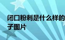 闭口粉刺是什么样的图片 闭口粉刺是什么样子图片