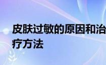 皮肤过敏的原因和治疗 皮肤过敏的原因和治疗方法