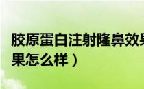 胶原蛋白注射隆鼻效果（胶原蛋白注射隆鼻效果怎么样）