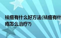 祛痘有什么好方法(祛痘有什么好方法?祛痘产品哪个好、痤疮怎么治疗?)