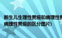 新生儿生理性黄疸和病理性黄疸的区分(新生儿生理性黄疸和病理性黄疸的区分图片)