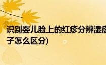 识别婴儿脸上的红疹分辨湿疹、幼儿急疹、痱子(宝宝脸上疹子怎么区分)