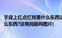 手背上红点红斑是什么东西这有问题吗(手背上红点红斑是什么东西?这有问题吗图片)