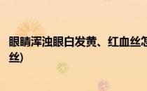 眼睛浑浊眼白发黄、红血丝怎么办(眼睛眼白浑浊发黄有红血丝)