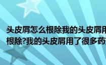 头皮屑怎么根除我的头皮屑用了很多药效果不好(头皮屑怎么根除?我的头皮屑用了很多药效果不好)