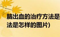 脑出血的治疗方法是怎样的(脑出血的治疗方法是怎样的图片)