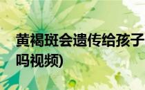 黄褐斑会遗传给孩子吗(黄褐斑会遗传给孩子吗视频)