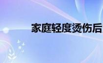 家庭轻度烫伤后紧急处理的方法