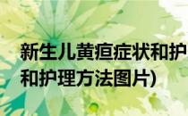 新生儿黄疸症状和护理方法(新生儿黄疸症状和护理方法图片)