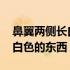 鼻翼两侧长白色的东西可以挤吗 鼻翼两侧长白色的东西