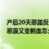 产后20天恶露反反复复,本来干净了又有血出来（产后20天恶露又变新血怎么回事）