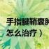 手指腱鞘囊肿怎么形成的原因（手指腱鞘囊肿怎么治疗）