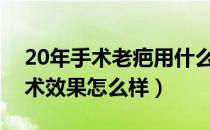 20年手术老疤用什么祛疤膏效果好（祛疤手术效果怎么样）