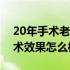 20年手术老疤用什么祛疤膏效果好（祛疤手术效果怎么样）