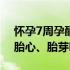 怀孕7周孕酮13有胎心胎芽（怀孕13周才见胎心、胎芽吗）