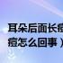 耳朵后面长痘痘怎么回事图片（耳朵后面长痘痘怎么回事）