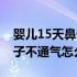 婴儿15天鼻子不通气怎么办（15天的婴儿鼻子不通气怎么办）