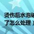 烫伤后水泡破了怎么不留疤痕（烫伤后水泡破了怎么处理）