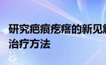 研究疤痕疙瘩的新见解可以为纤维化提供新的治疗方法